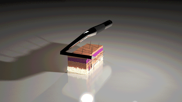 d51b166fd7866c1d0dcf81c9935ae913_original.gif d51b166fd7866c1d0dcf81c9935ae913_original.gif